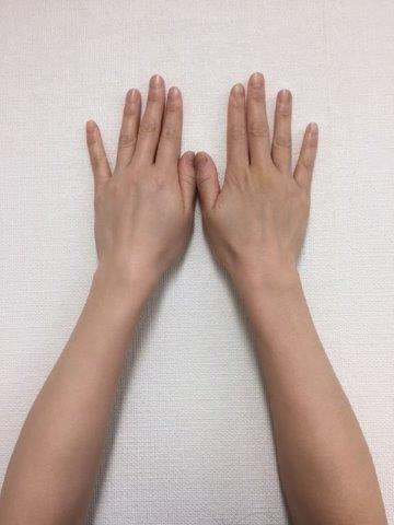 写真③腕.JPG